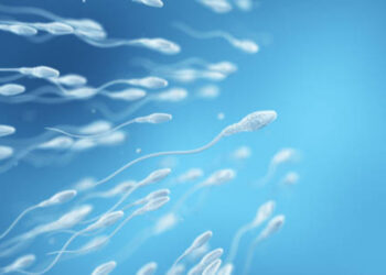 Watery Sperm